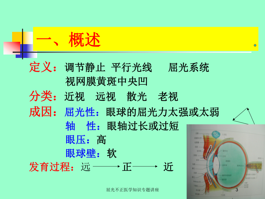 屈光不正医学知识专题讲座培训课件.ppt_第3页