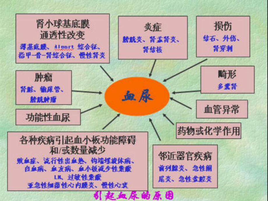 左肾静脉压迫综合征(胡桃夹现象)诊治近况培训课件.ppt_第3页