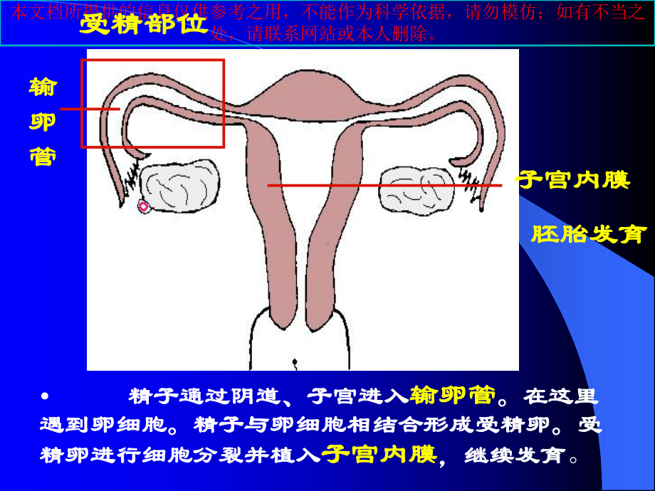 异位妊娠新进展培训课件.ppt_第3页