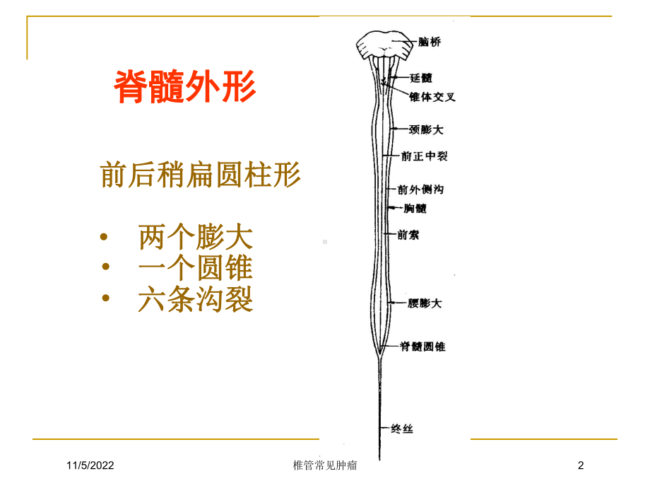 椎管常见肿瘤培训课件.ppt_第2页