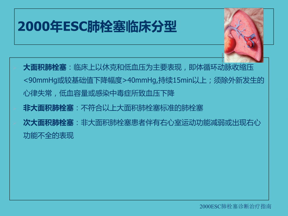 授课用-高危肺栓塞及心肺复苏中的溶栓治疗课件.ppt_第2页