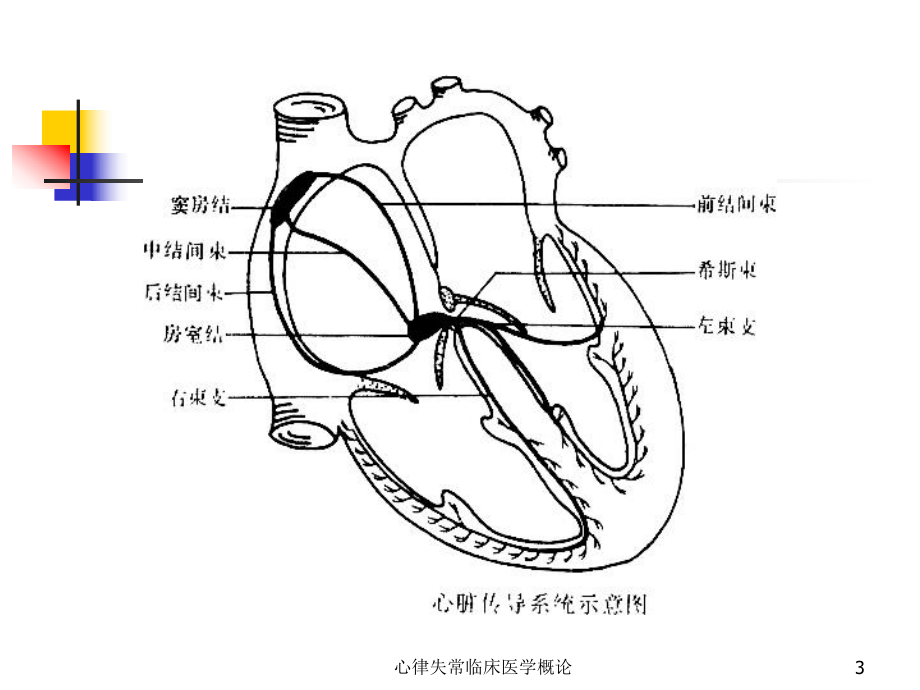 心律失常临床医学概论课件.ppt_第3页