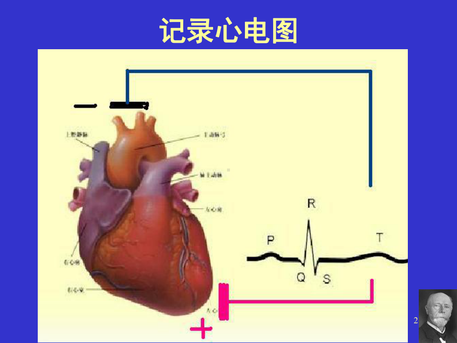 影像专升本诊断学心电图课件.ppt_第2页