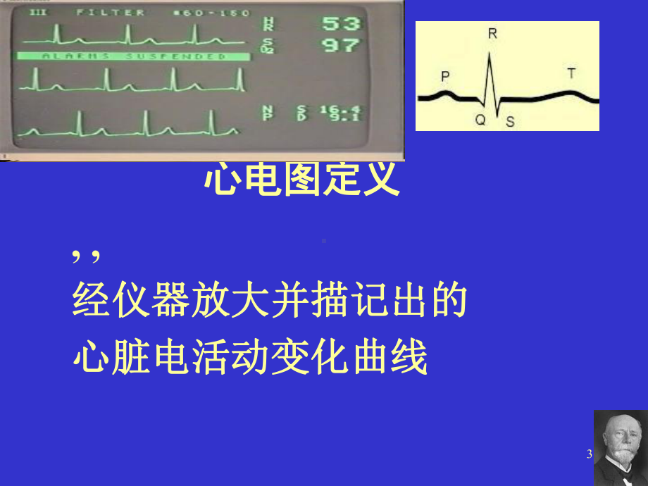 影像专升本诊断学心电图课件.ppt_第3页