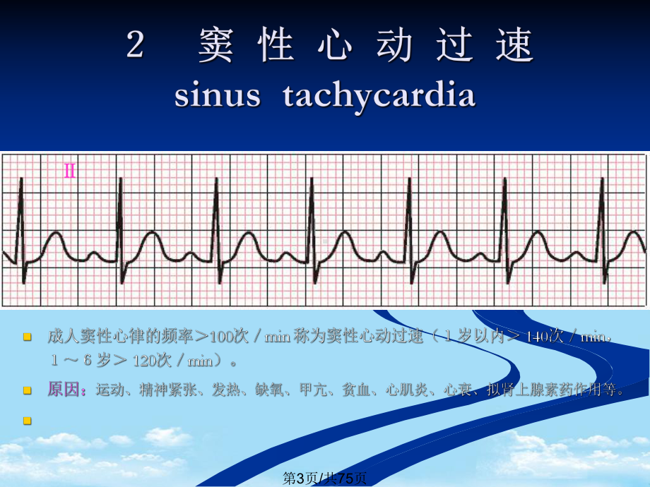 心电图学全面版课件.pptx_第3页