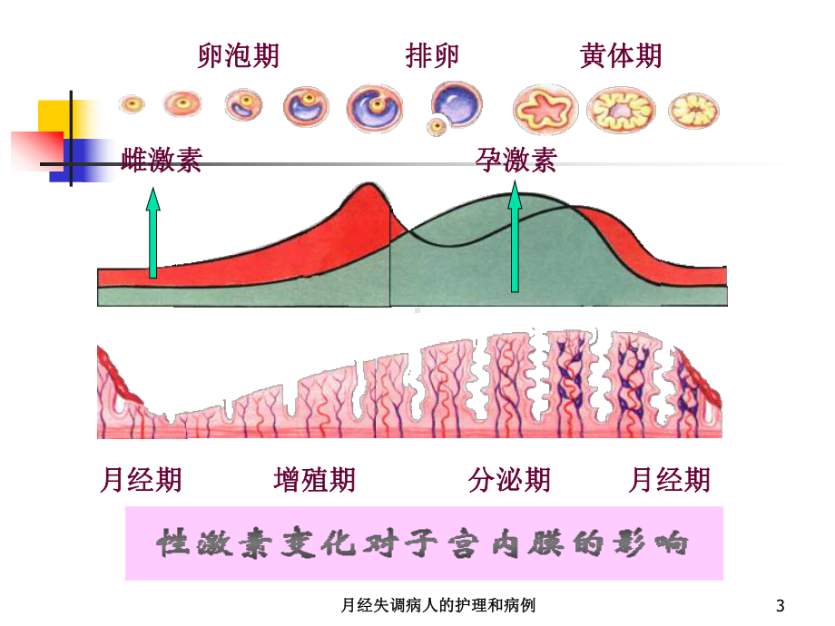 月经失调病人的护理和病例培训课件.ppt_第3页