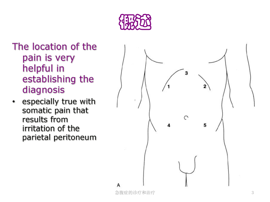 急腹症的诊疗和治疗培训课件.ppt_第3页