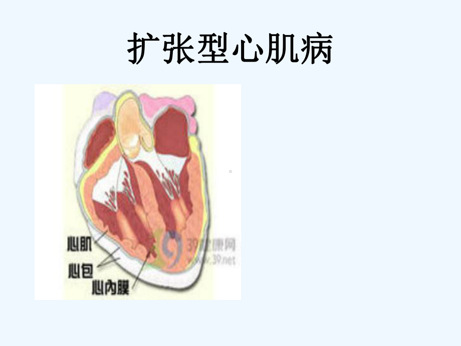 扩张型心肌病查房课件.ppt_第1页