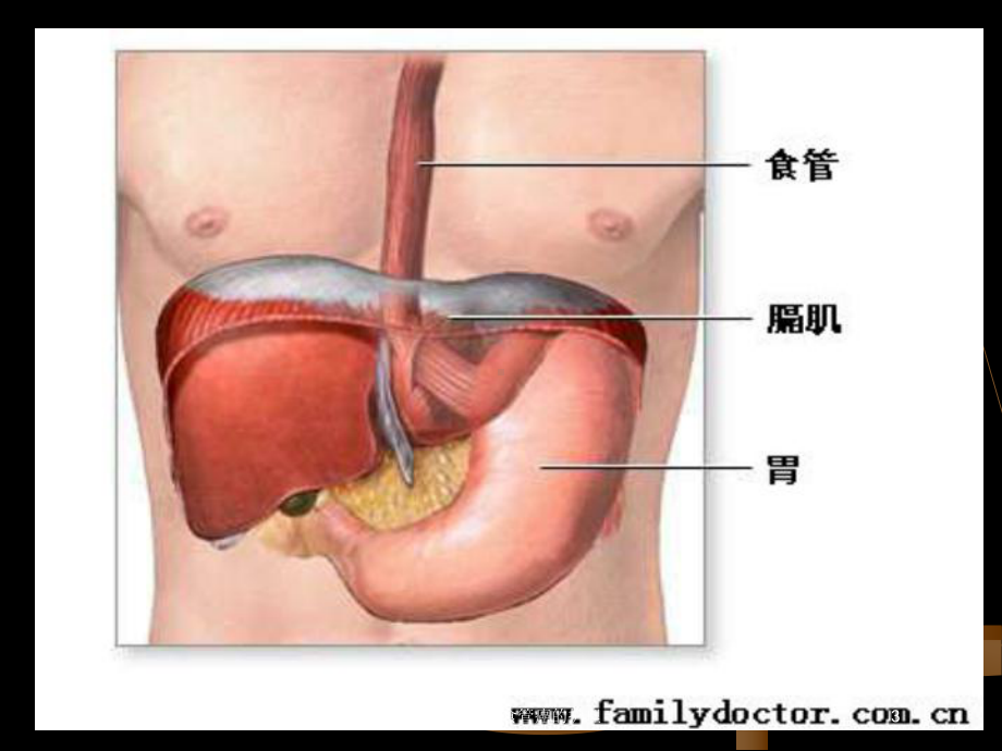 心胸外科查房食管癌的护理培训课件.ppt_第3页