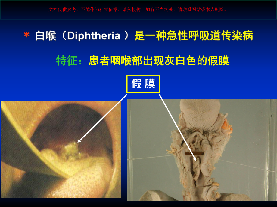 棒状杆菌属专题培训培训课件.ppt_第3页