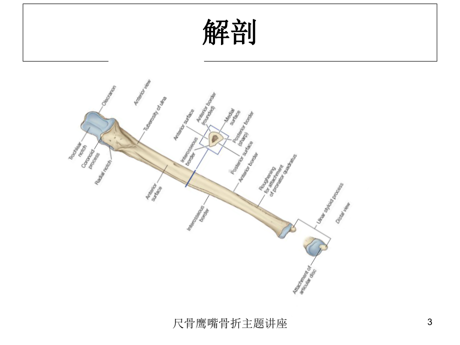 尺骨鹰嘴骨折主题讲座培训课件.ppt_第3页