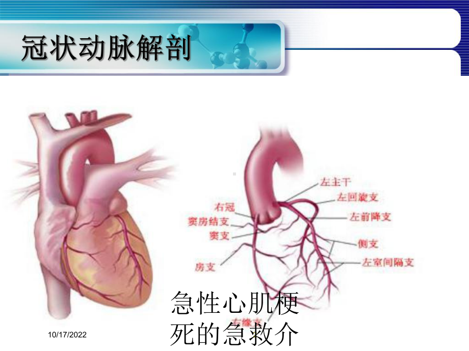 急性心肌梗死的急救介入护理培训课件.ppt_第2页