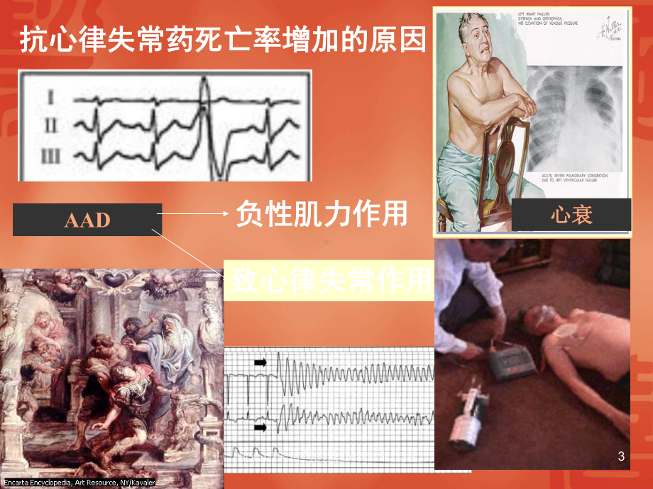 抗心律失常药的致心律失常作用课件.ppt_第3页