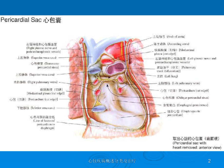 心包疾病概述分类及治疗课件.ppt_第2页