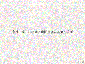 急性右室心肌梗死心电图表现及其鉴别诊断标准课件.ppt