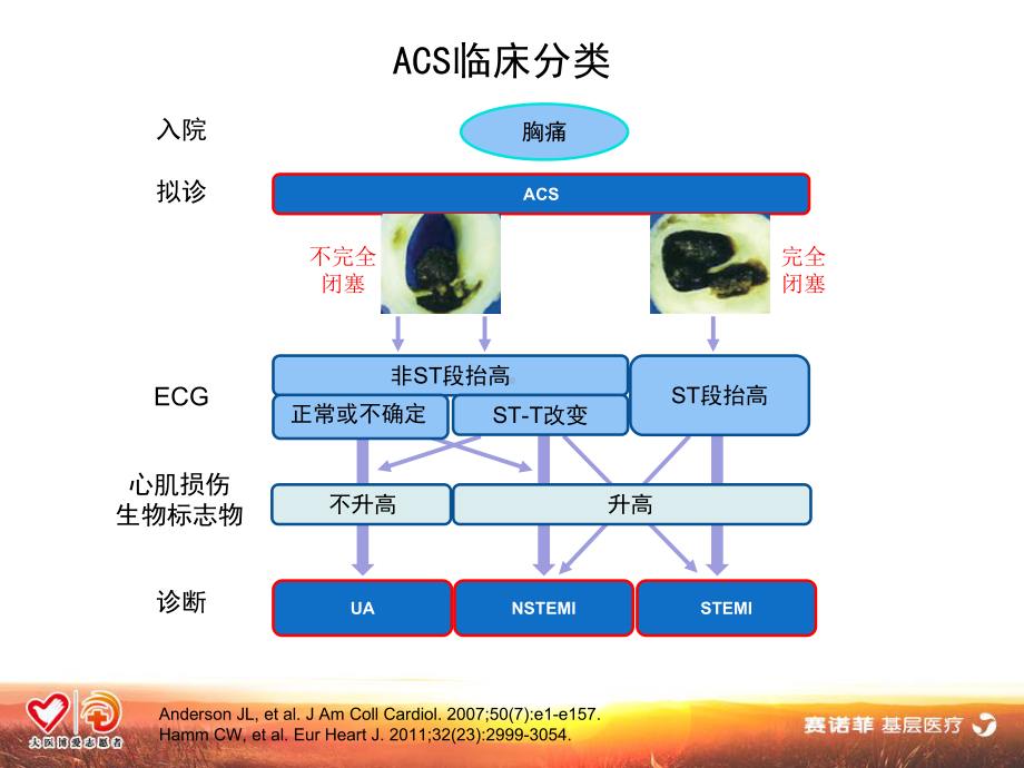 抗血小板治疗课件-2.ppt_第3页