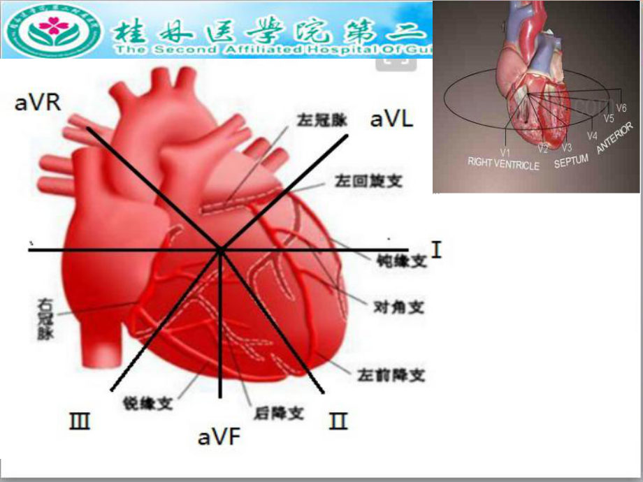 心肌梗死犯罪血管定位诊断课件.ppt_第3页