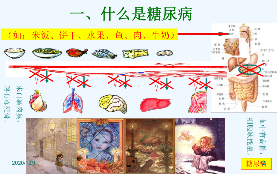 有关糖尿病知识课件.ppt_第2页