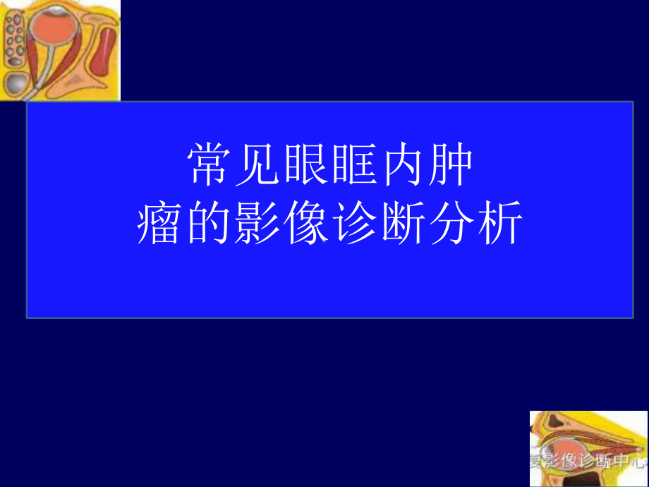 常见眼眶内肿瘤的影像诊断分析医学课件.pptx_第1页