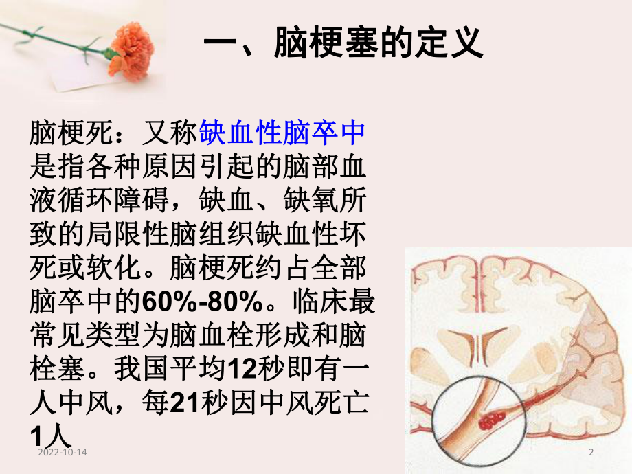 急性脑梗塞溶栓治疗护理参考课件.ppt_第2页