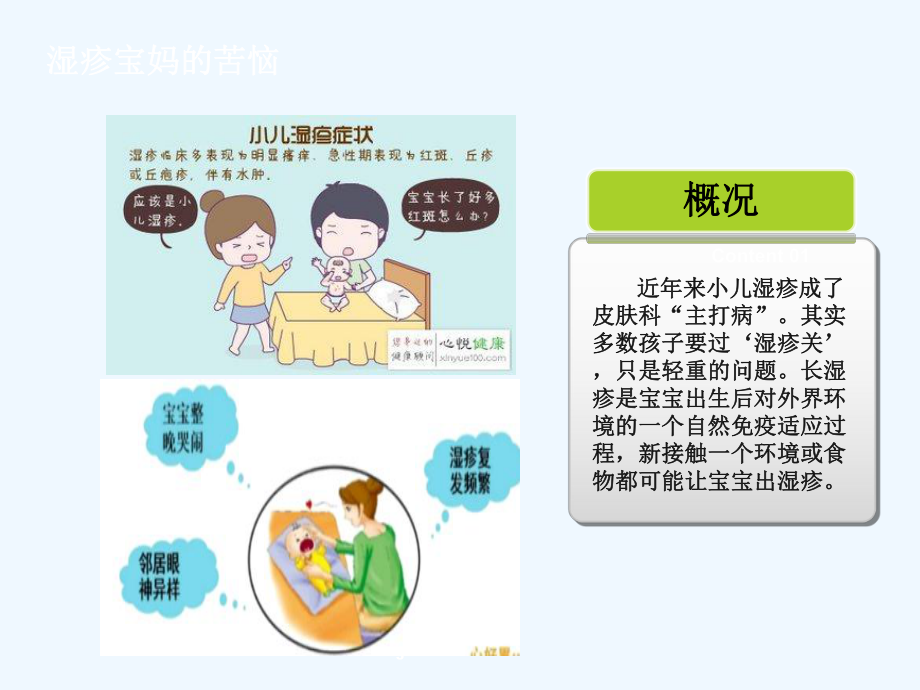 幼儿湿疹翻转课堂课件.ppt_第3页