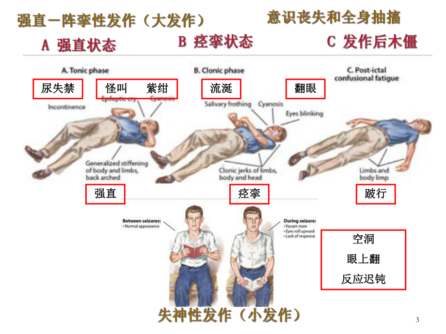 抗癫痫药抗帕金森药课件.ppt_第3页