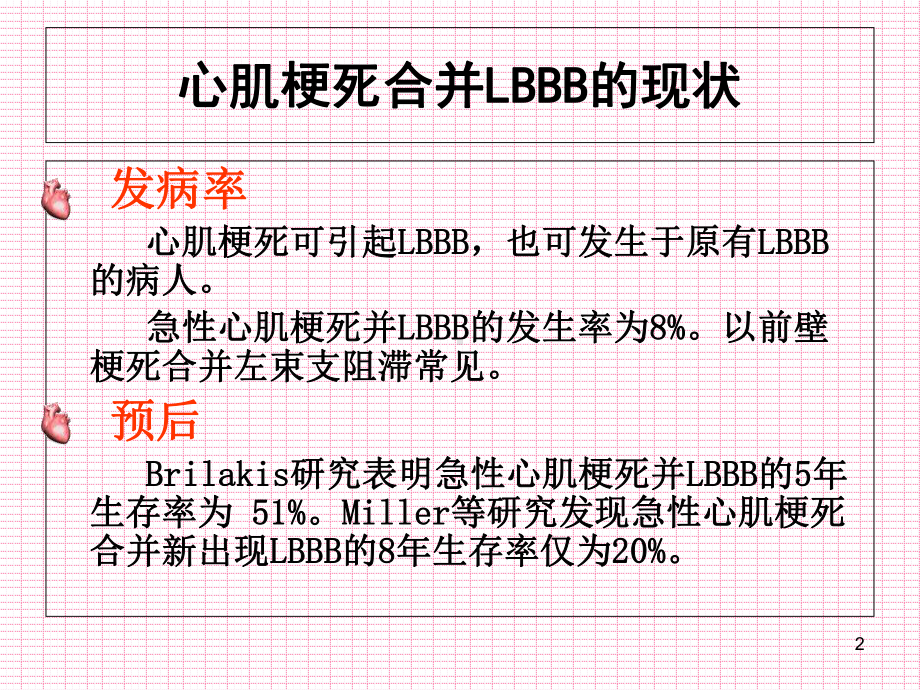 心肌梗死合并LBBB的心电图诊断教学课件.ppt_第2页