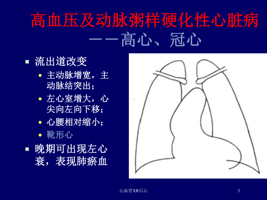 心血管XR后心培训课件.ppt_第3页