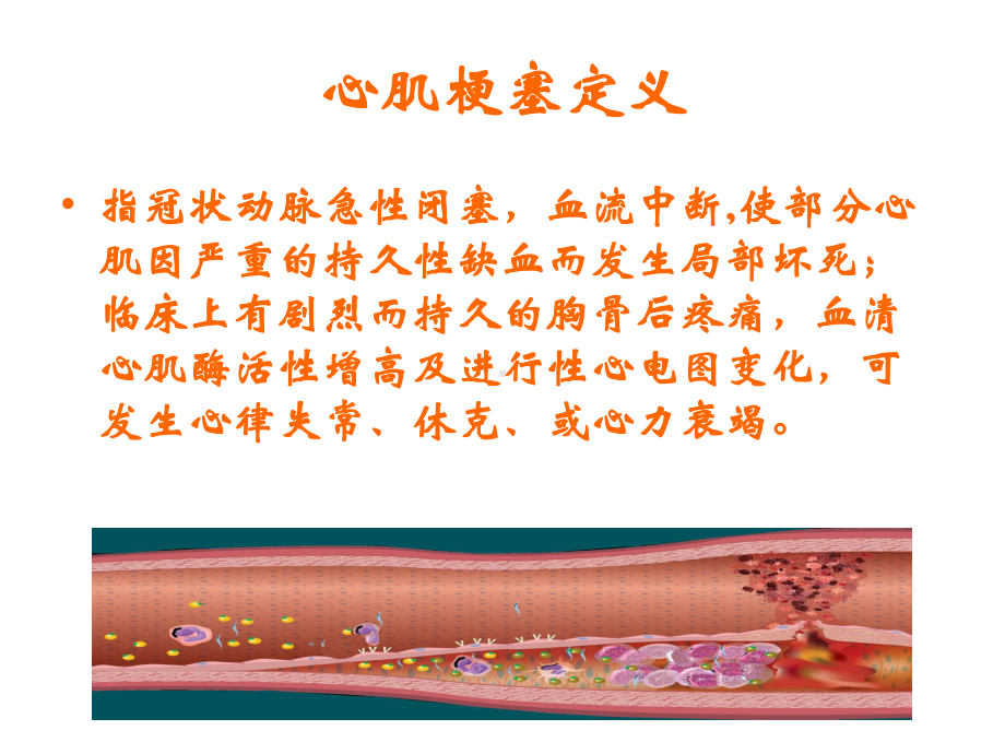 急性心梗护理查房课件.ppt_第3页