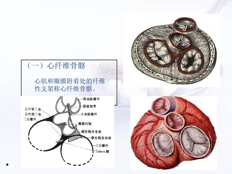 心脏粘液瘤学习课件.ppt_第2页