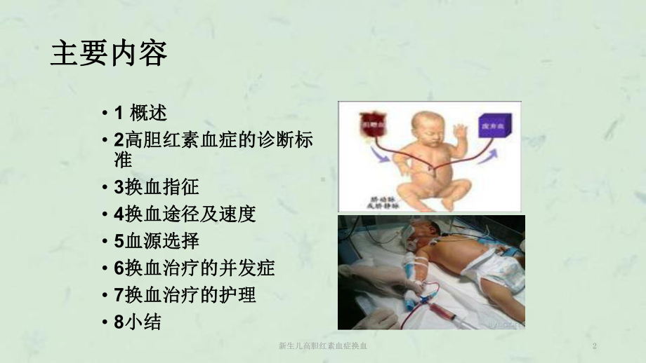 新生儿高胆红素血症换血课件.ppt_第2页