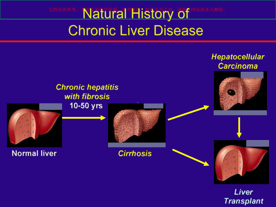 慢性肝病和肝纤维化课件.ppt_第2页