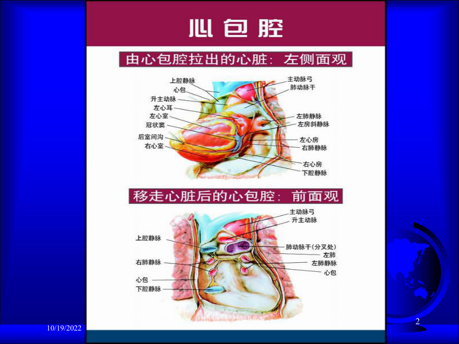 心包疾病心脏肿瘤培训课件.ppt_第2页