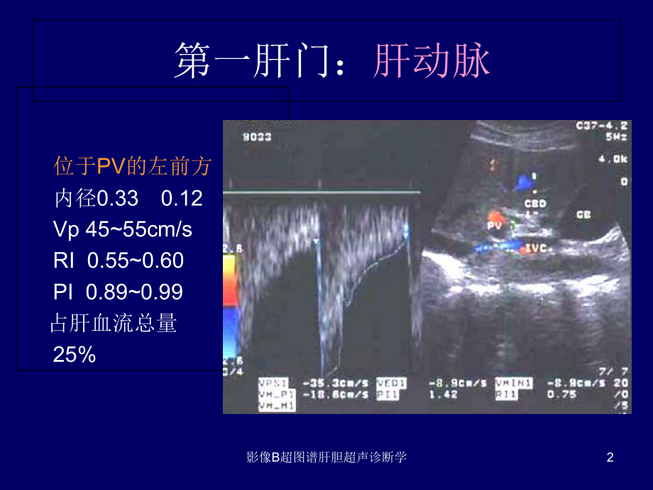 影像B超图谱肝胆超声诊断学培训课件.ppt_第2页