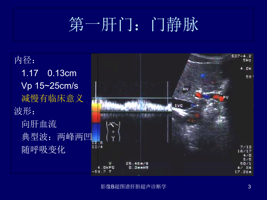 影像B超图谱肝胆超声诊断学培训课件.ppt_第3页