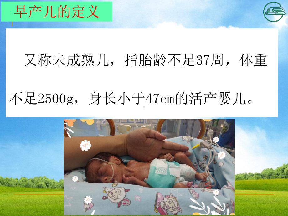 早产儿护理查房完整可编辑课件.ppt_第3页