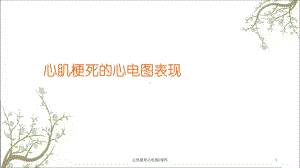 心肌梗死心电图h课件.ppt
