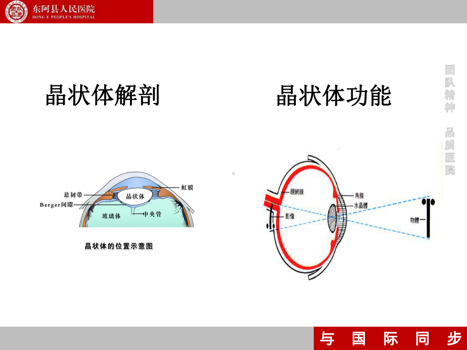 晶状体病幻灯参考课件.ppt_第3页