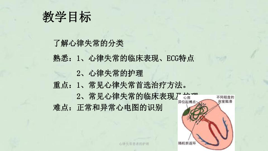 心律失常患者的护理课件.ppt_第2页