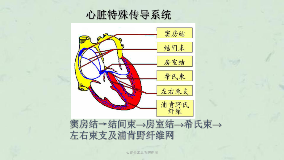 心律失常患者的护理课件.ppt_第3页