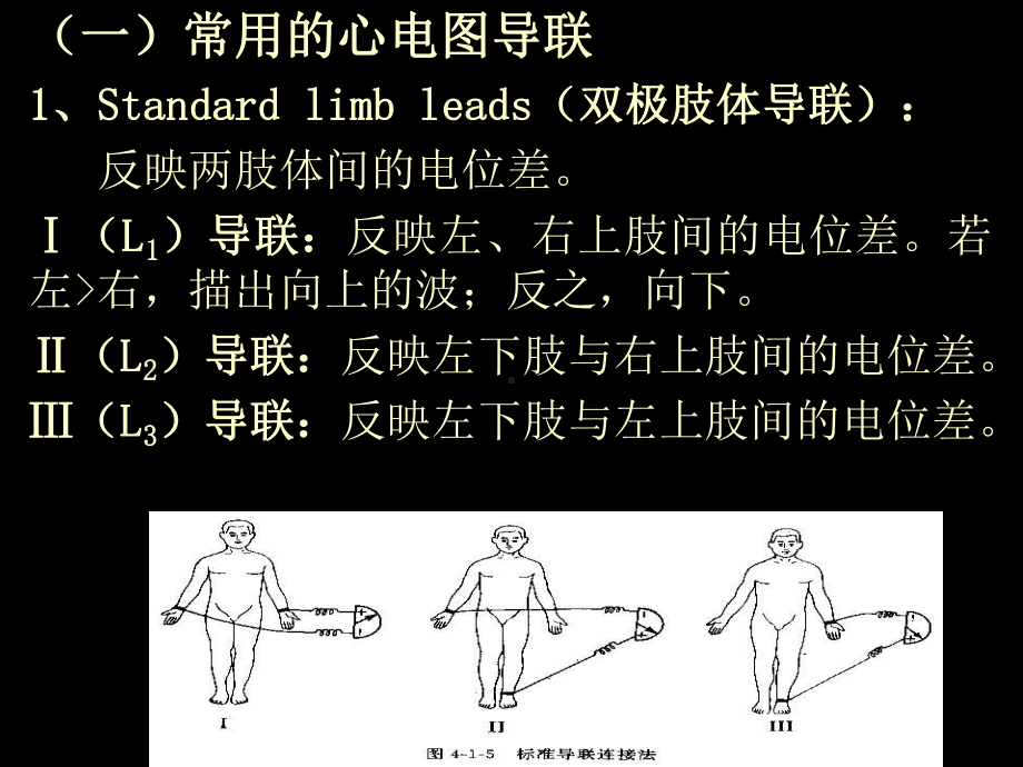 常见典型心电图诊断-课件.ppt_第3页