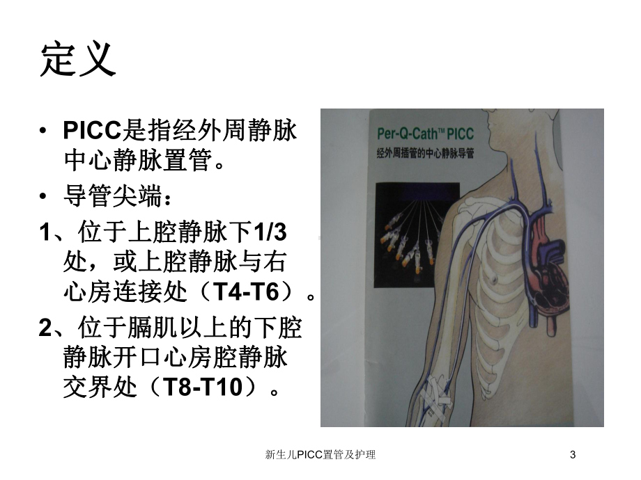 新生儿PICC置管及护理培训课件.ppt_第3页