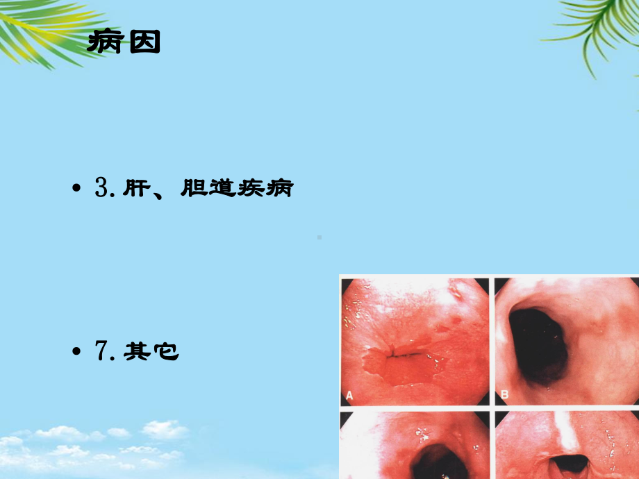 教培用西医诊断学呕血与便血课件.ppt_第3页