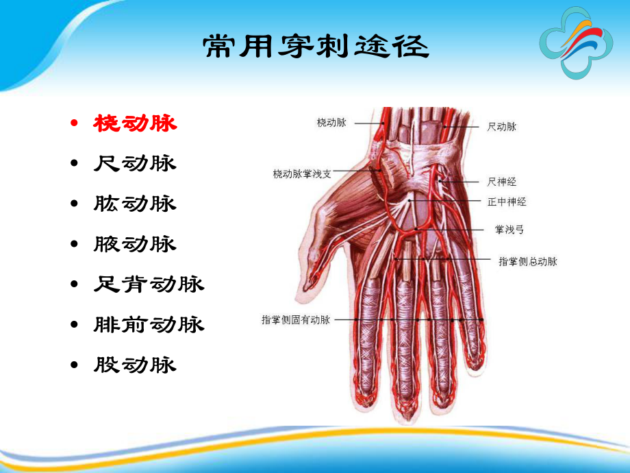 有创动脉血压监测的探讨参考课件.ppt_第2页