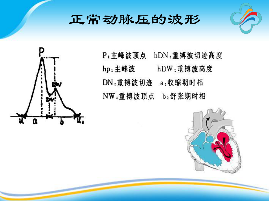 有创动脉血压监测的探讨参考课件.ppt_第3页