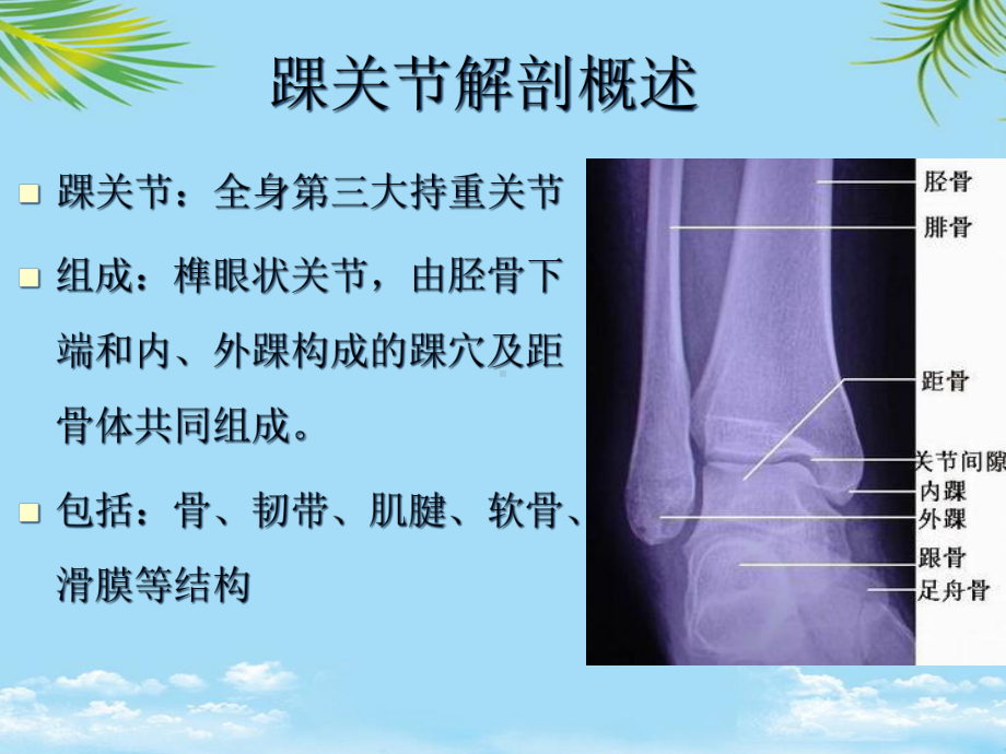 教培用踝关节损伤磁共振诊断课件.ppt_第2页