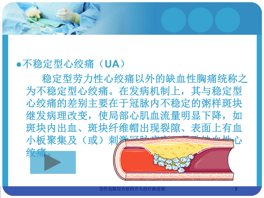 急性冠脉综合症的介入治疗新进展培训课件.ppt_第3页