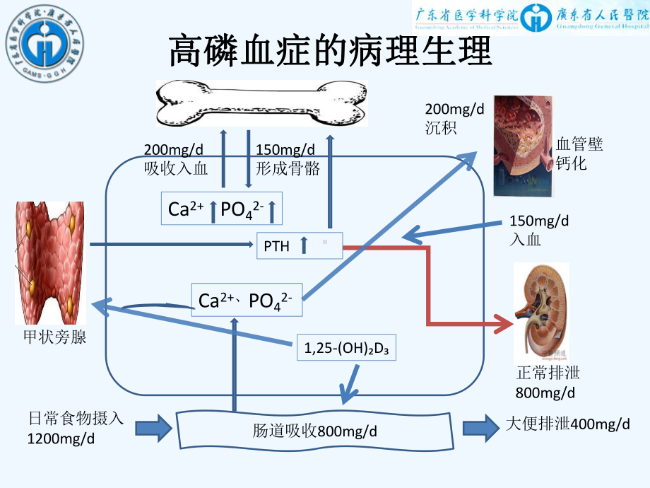 新型磷结合剂在慢性肾脏病中的应用课件.ppt_第2页