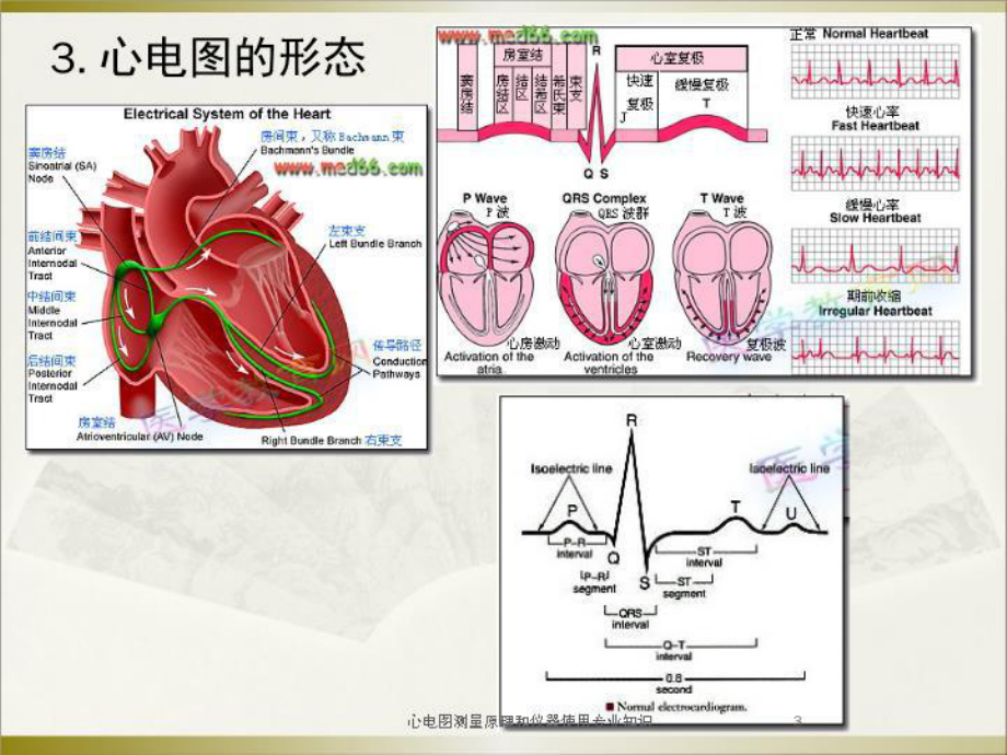 心电图测量原理和仪器使用专业知识培训课件.ppt_第3页