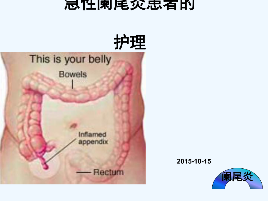 急性阑尾炎患者护理课件.ppt_第1页